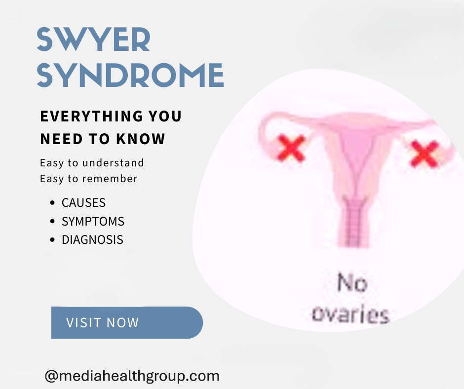 Swyer Syndrome