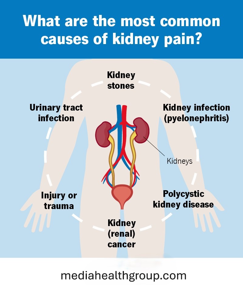 Kidney Location on Back