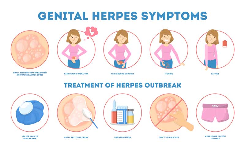 Genital Herpes
