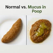 8 Shocking Facts About Fecal Mucus and What it Means 