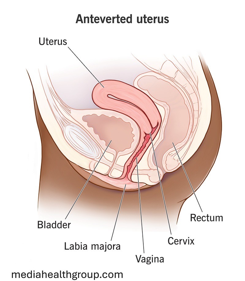 Anteverted Uterus