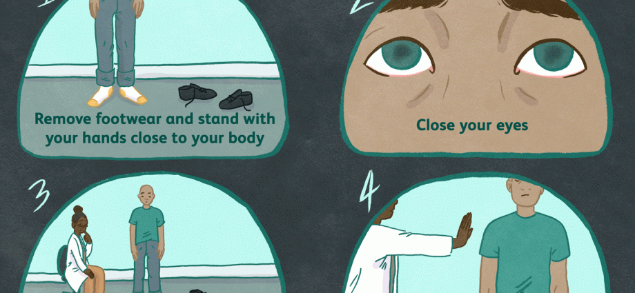 Romberg Test and 7 Alarming Facts About It