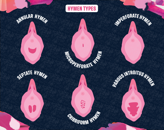 Hymenal Tags: 5 Fascinating Facts You Should Know